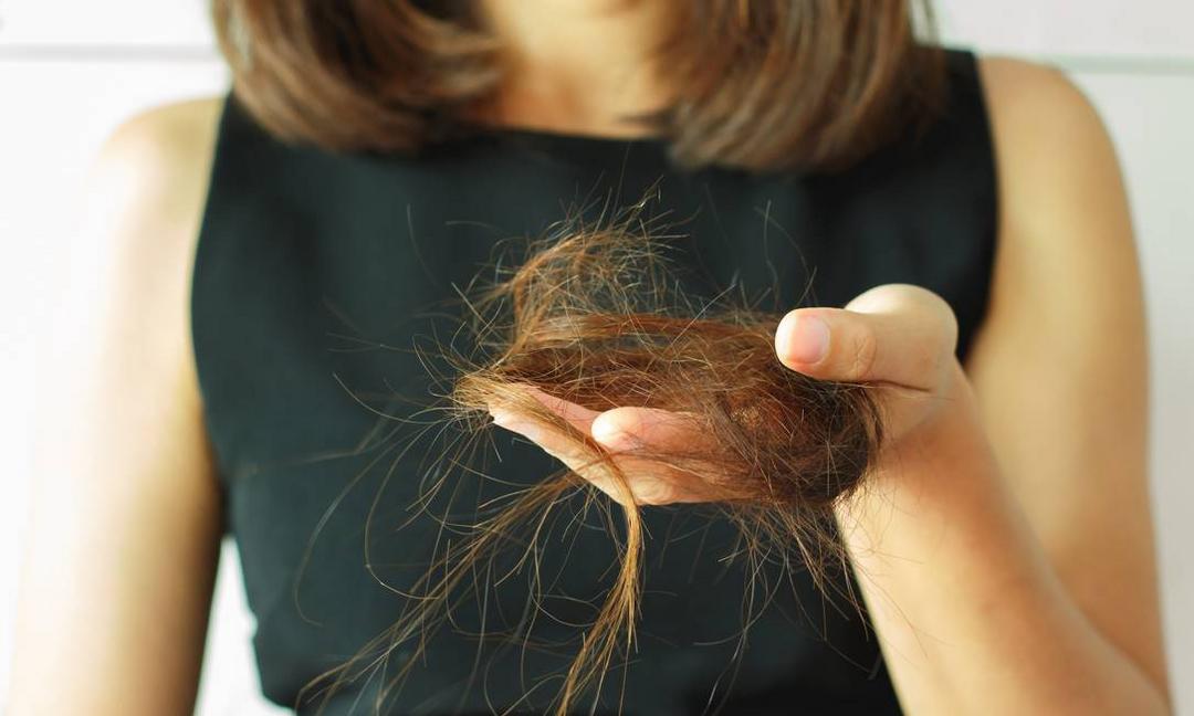 As principais causas da queda de cabelo.