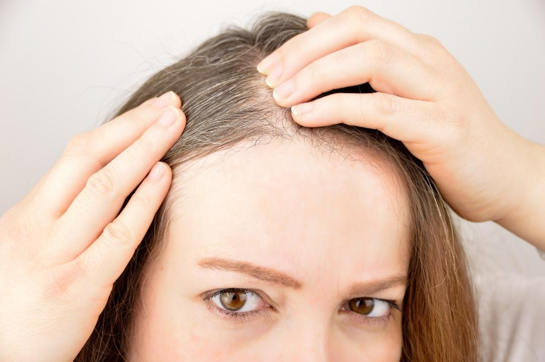 Quais as doenças do couro cabeludo?
